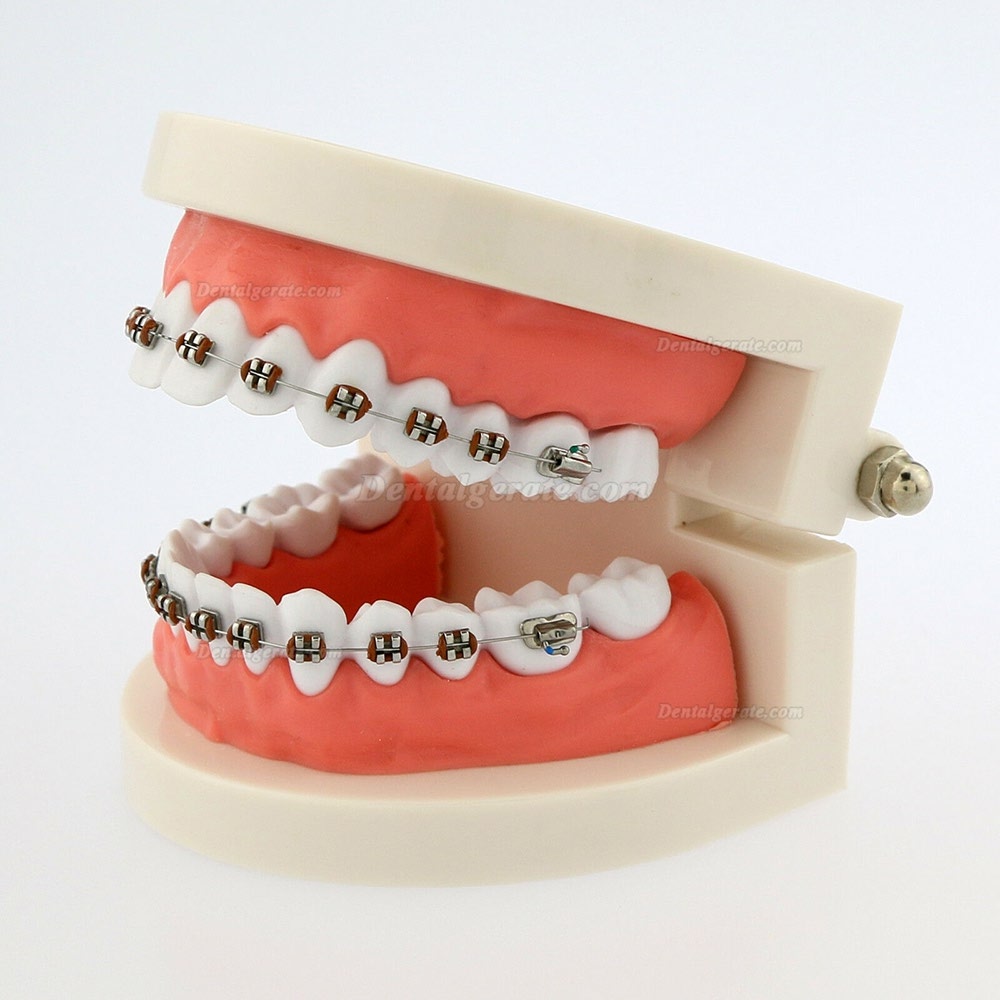 Dental Teach Typodont Demonstrationszahnmodell mit Zahnspangen F&uuml;r die Patientenstudie 5006
